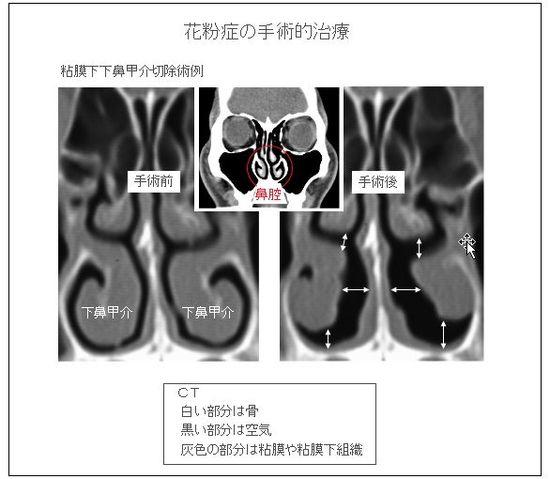 20140402-6.jpg