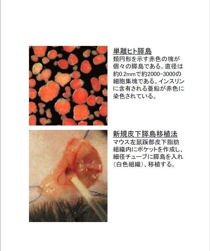 基盤研究機関研究所紹介 膵島研究所 糖尿病の根治的治療法開発を目指す 研究 Fukudaism フクダイズム 福岡大学