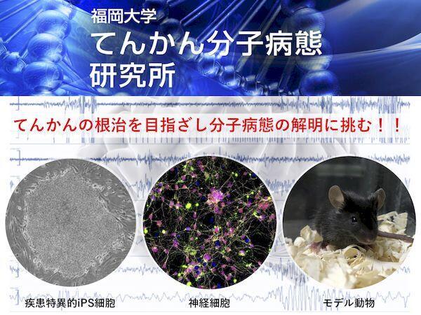 基盤研究機関研究所紹介】てんかん分子病態研究所～日本で唯一の